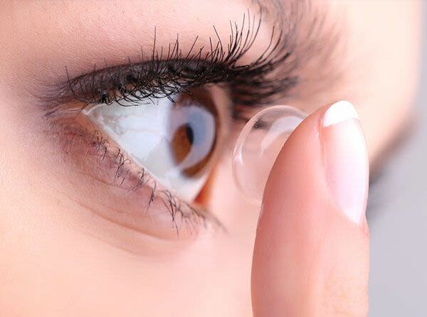 Cosmetic Contact Lens Injuries