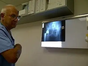 depuy hip