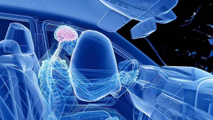 car accident head hitting airbag